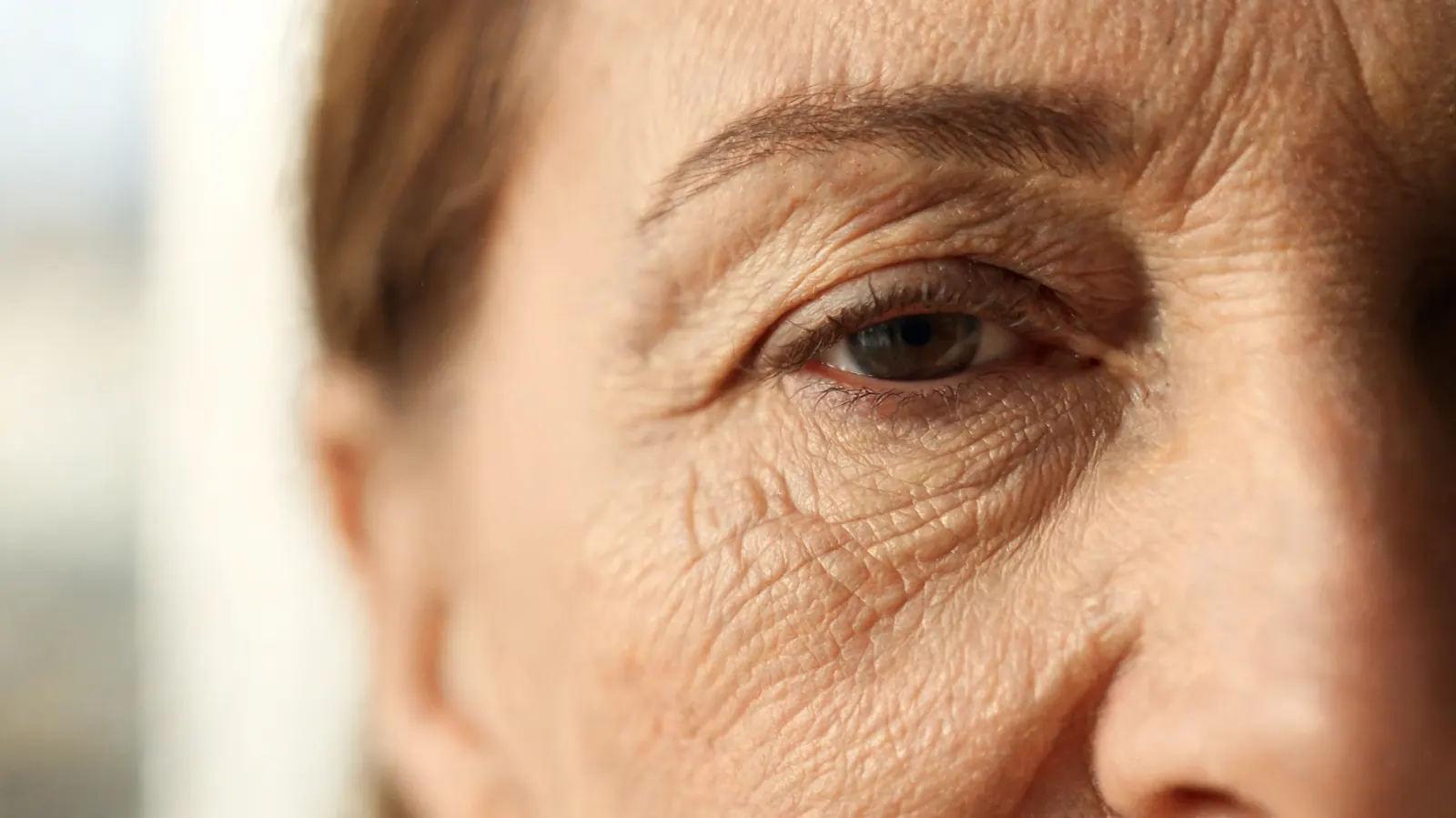 Close-up of the delicate under-eye area showing subtle texture and fine lines, soft diffused light, clinical but warm photography